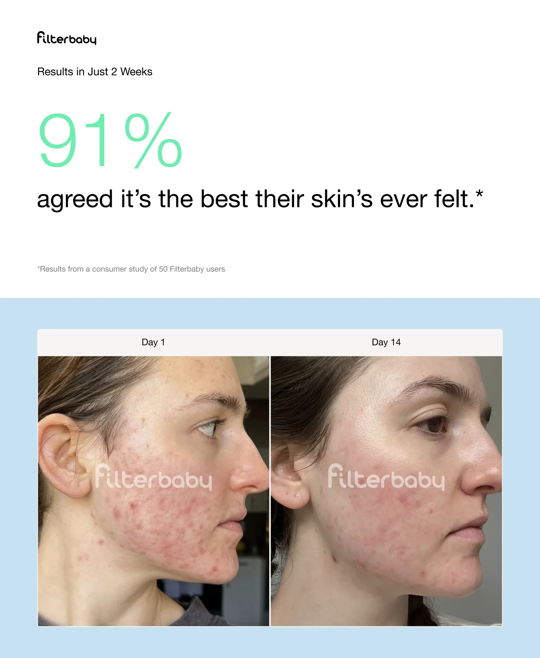 Filterbaby Skincare Filter 2.0 (2 Filter Refills Included) - Image 47